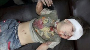 Five year old Omar Daqneesh whose image went worldwide is shown following treatment by doctors in Aleppo (Twitter)